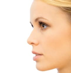 Rhinoplasty