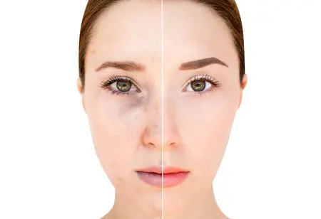 Before & After Images
