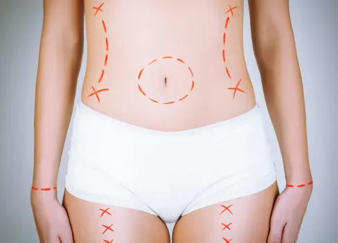  plastic surgeons west palm beach 