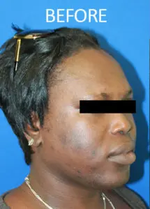 Mardirossian Facial Aesthetics Before and After Pictures