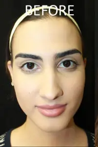 Mardirossian Facial Aesthetics Before and After Pictures