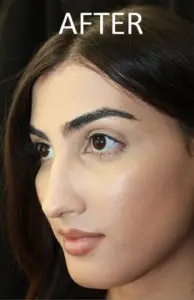 Mardirossian Facial Aesthetics Before and After Pictures