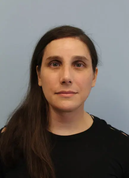 Mardirossian Facial Aesthetics Before and After Pictures
