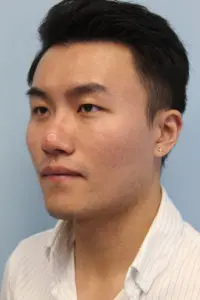 Mardirossian Facial Aesthetics Before and After Pictures