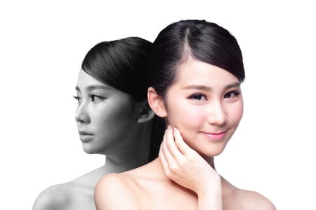 Asian Plastic Surgery