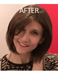 Mardirossian Facial Aesthetics Before and After Pictures