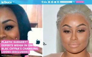 Facial Plastic Surgery in West Palm Beach, FL