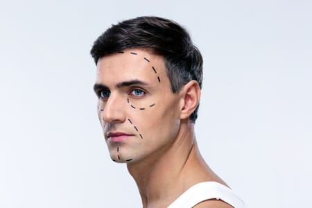 Plastic Surgery for Men