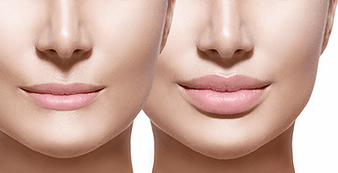 Shaving and Contouring Procedures