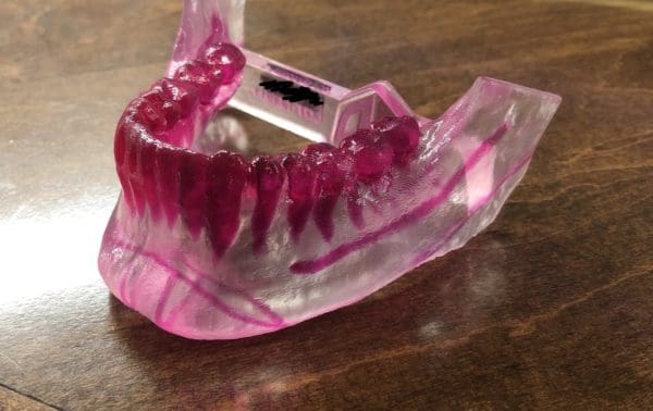 Mandible Contouring in West Palm Beach, FL