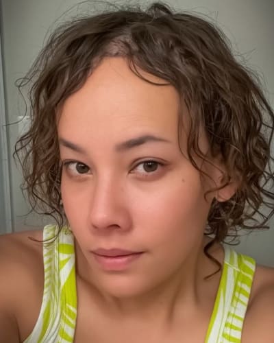 Mardirossian Facial Aesthetics Before and After Pictures